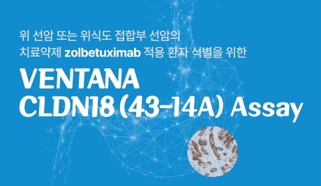 VENTANA CLDN18 (43-14A) 검사
