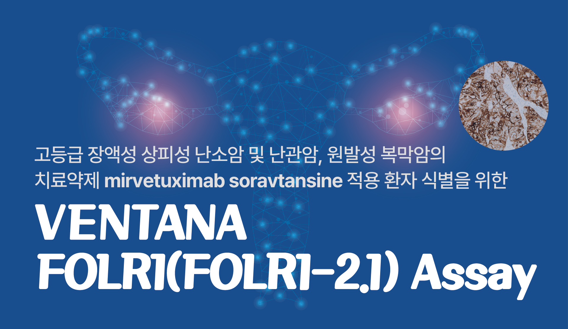 VENTANA FOLR1 (FOLR1-2.1) 검사