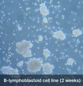 B-lymphoblastoid cell line (2 weeks)